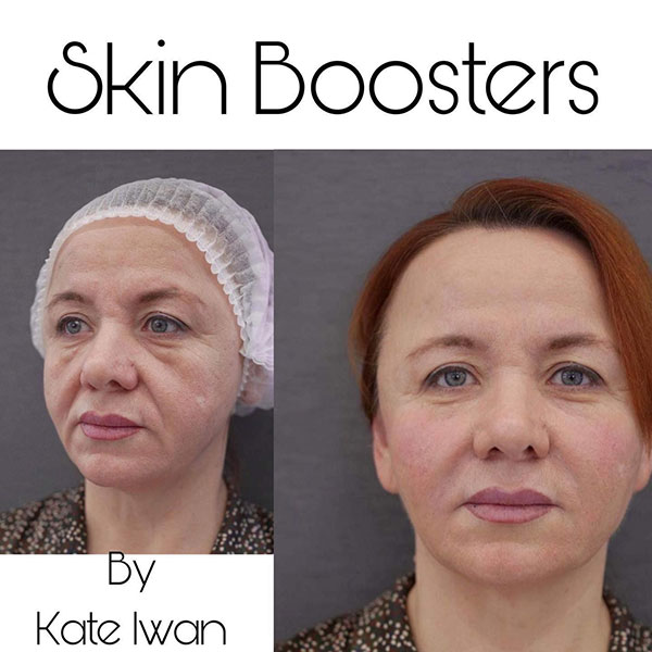 Premium Skin Booster